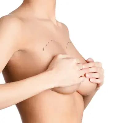 Breast Enlargement