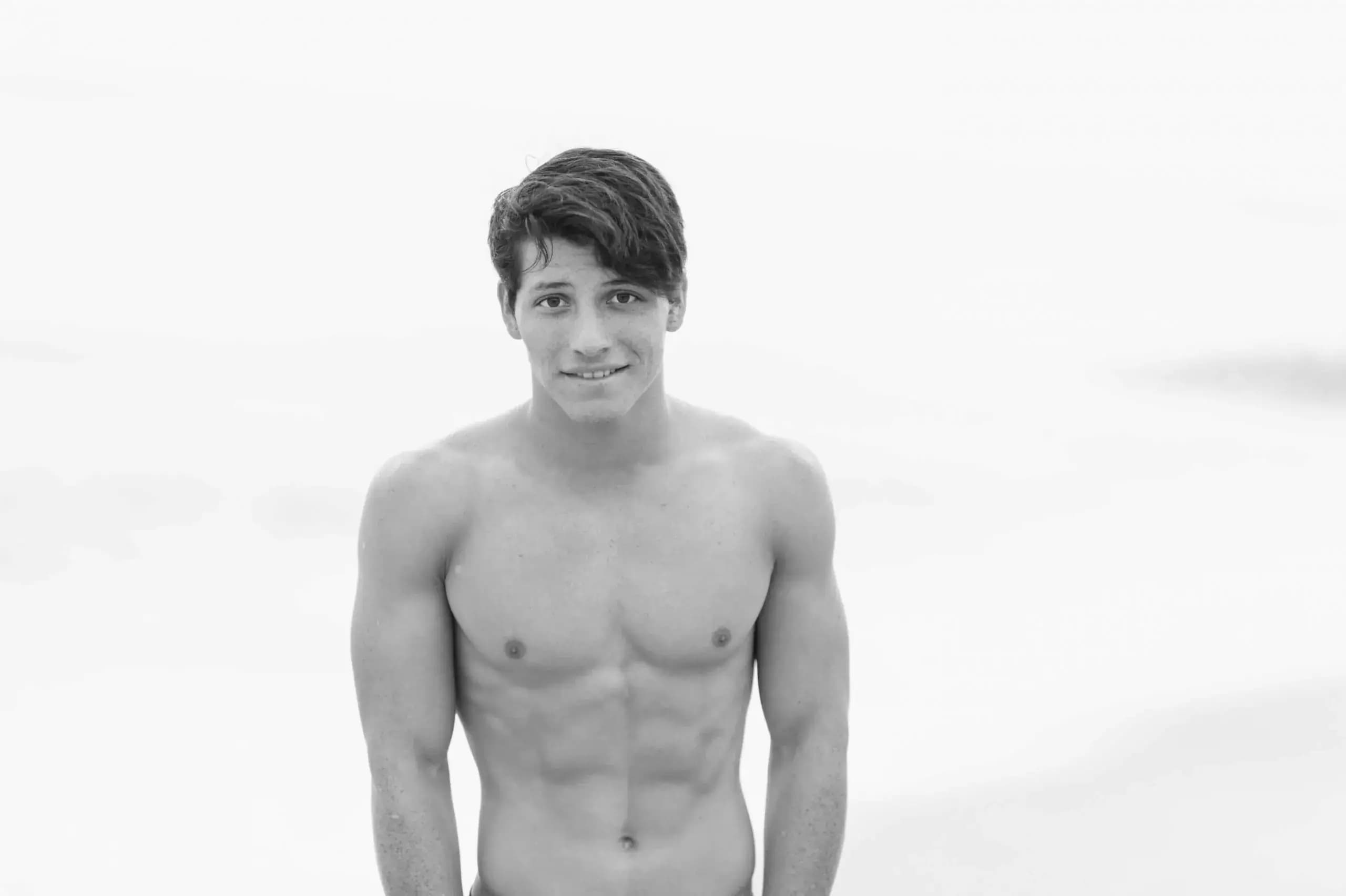 Gynecomastia