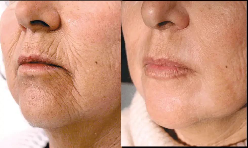 Before & After Treatment