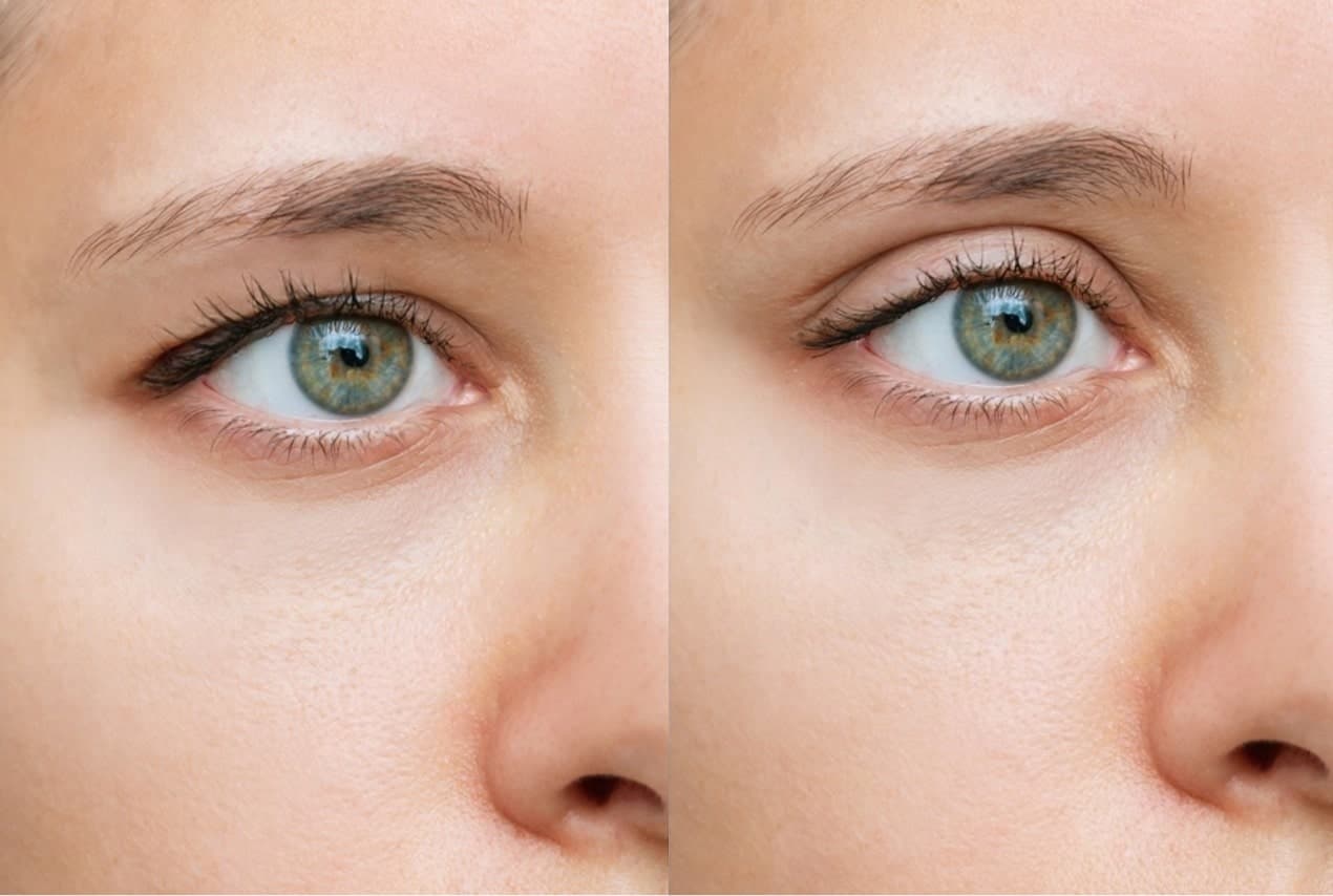 Before & After - Patient 2