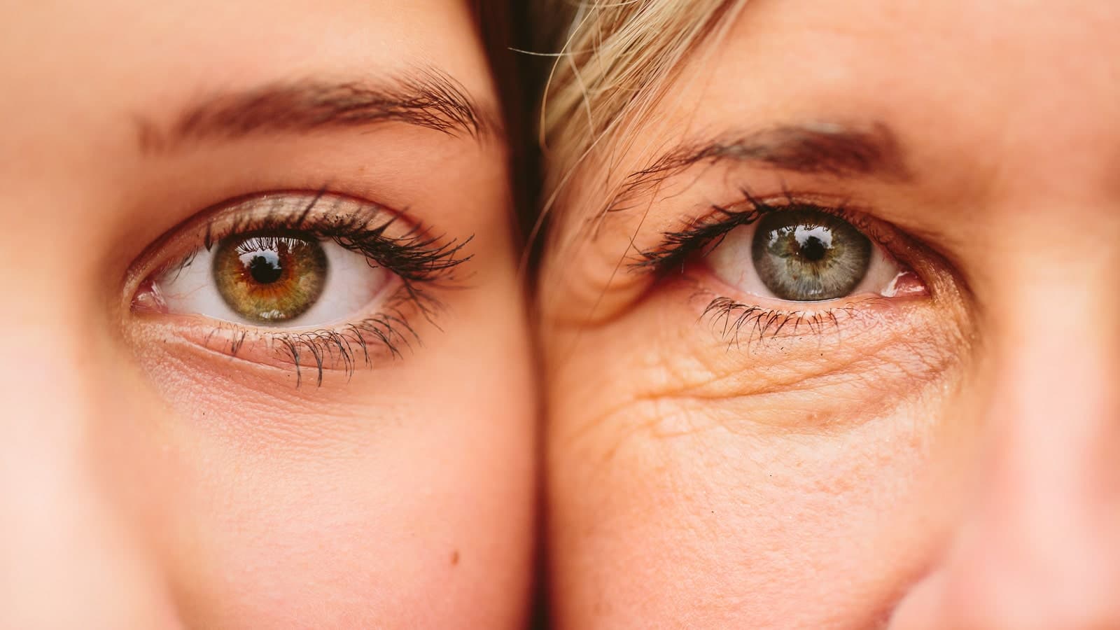 Woman with refreshed eyes after eyelid lift