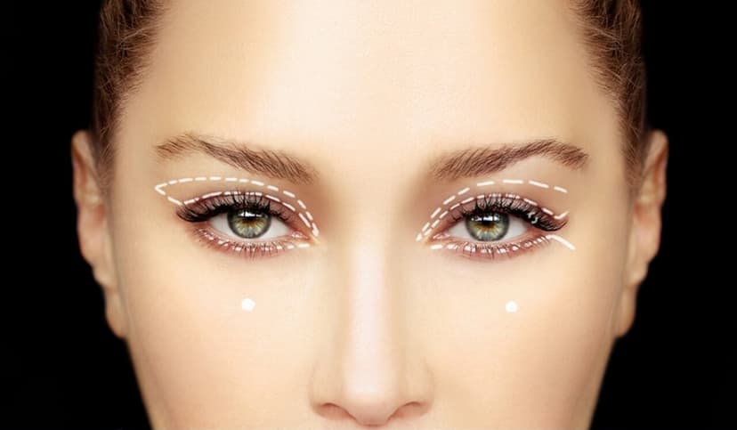 Eyelid Lift (Blepharoplasty)